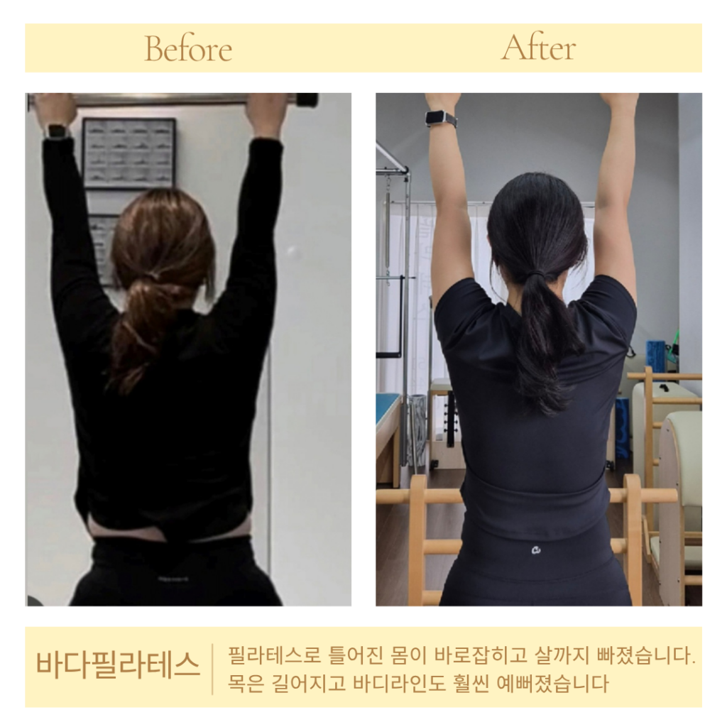 [바다필라테스&바레] 여름철 늘어진 팔뚝살, 무작정 굶고 계신가요? 핵심은 ‘등 움직임’과 ‘승모근 분리’ 2