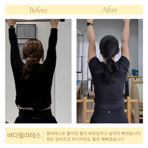 [바다필라테스&바레] 여름철 늘어진 팔뚝살, 무작정 굶고 계신가요? 핵심은 ‘등 움직임’과 ‘승모근 분리’