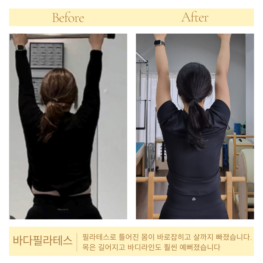 [바다필라테스&바레] 여름철 늘어진 팔뚝살, 무작정 굶고 계신가요? 핵심은 ‘등 움직임’과 ‘승모근 분리’ 1